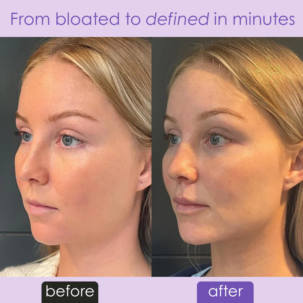 ✨ Uplift Massaging Beauty Roller – Glow Naturally, Every Day