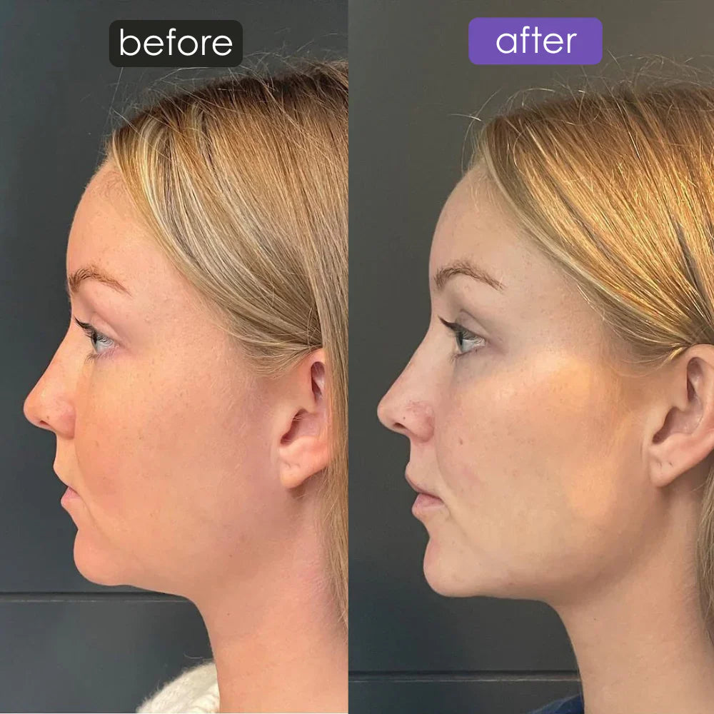 ✨ Uplift Massaging Beauty Roller – Glow Naturally, Every Day