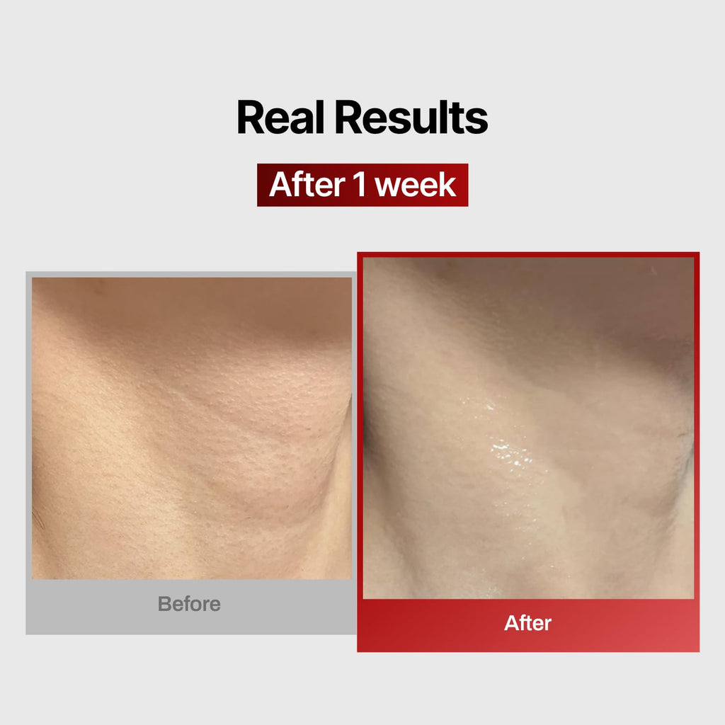 Wrinkle-fit Neck Mask 1 Box (Pack of 7) + Boosting Roller