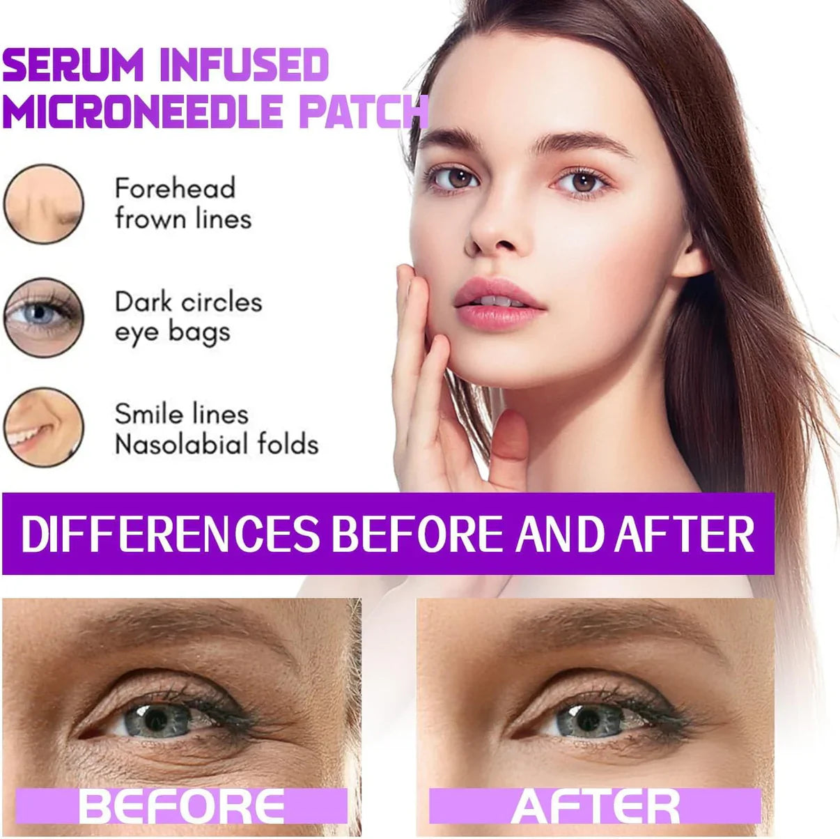 Microneedling Eye Patches (Pack of 4)