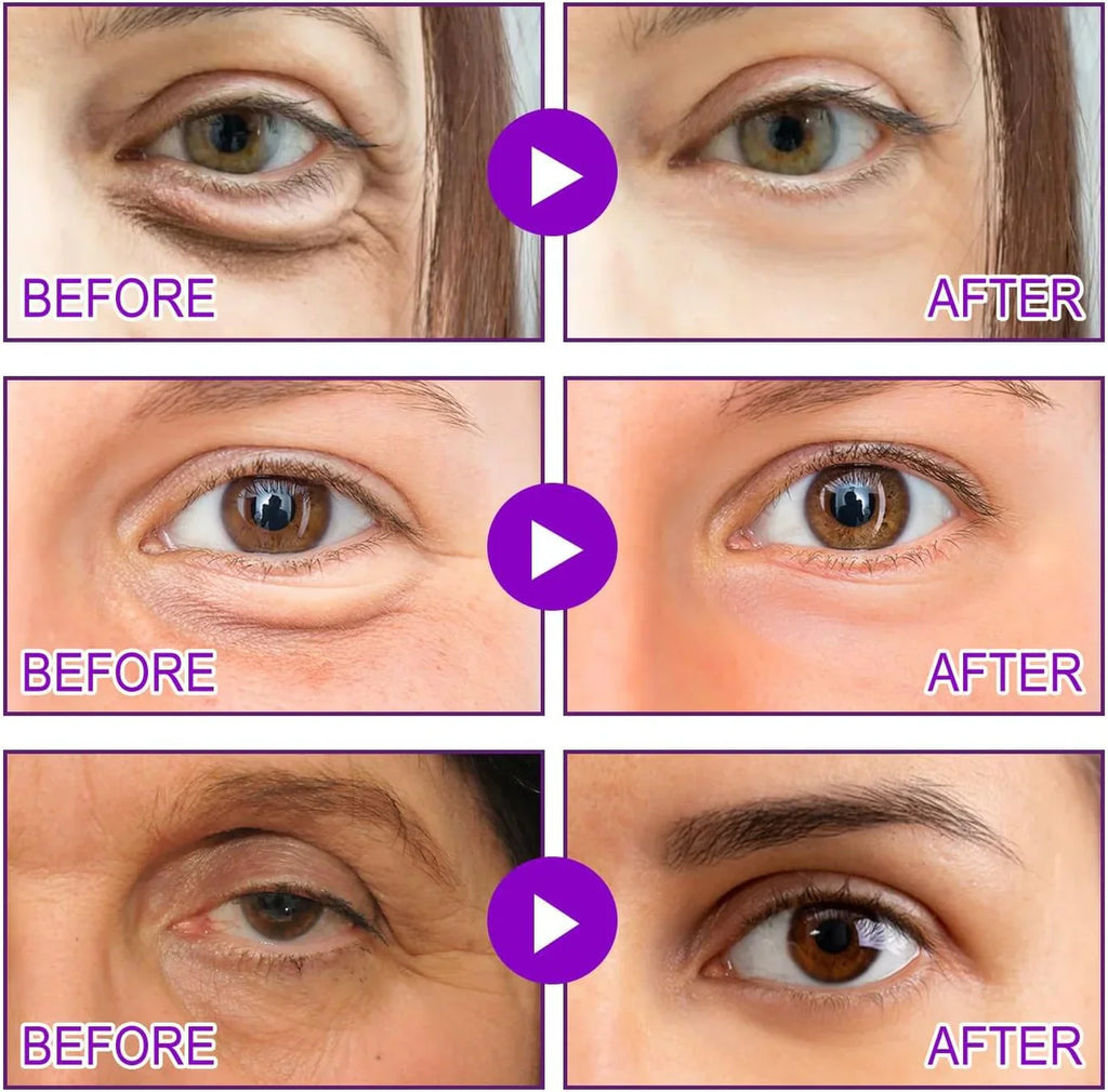 Microneedling Eye Patches (Pack of 4)