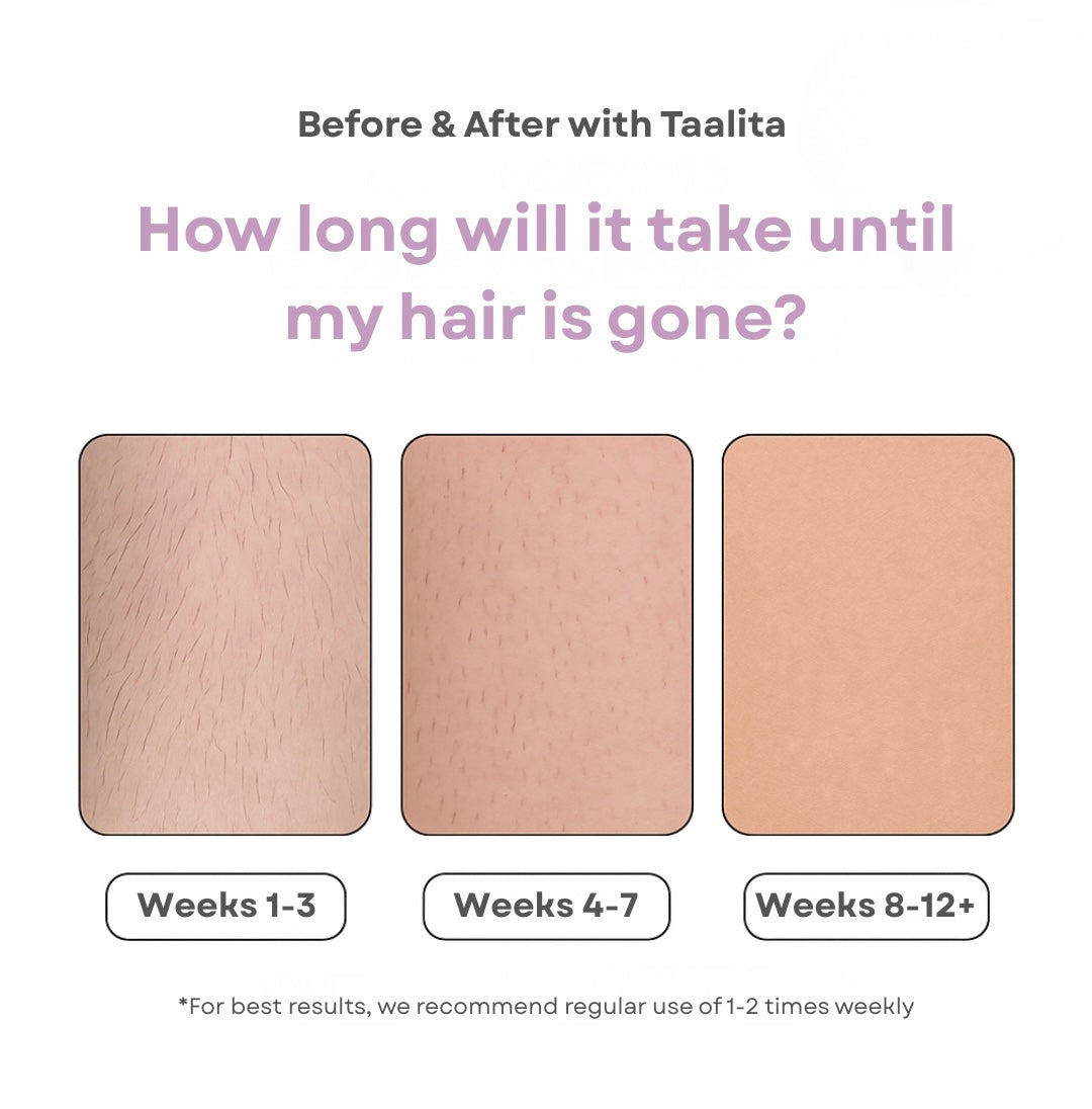 bennett IPL Hair Remover I The leading laser hair removal for your home