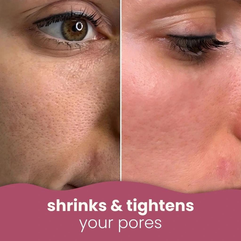 Turmeric Kojic Acid Pads